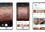 Google Lens теперь умеет распознавать заболевания кожи