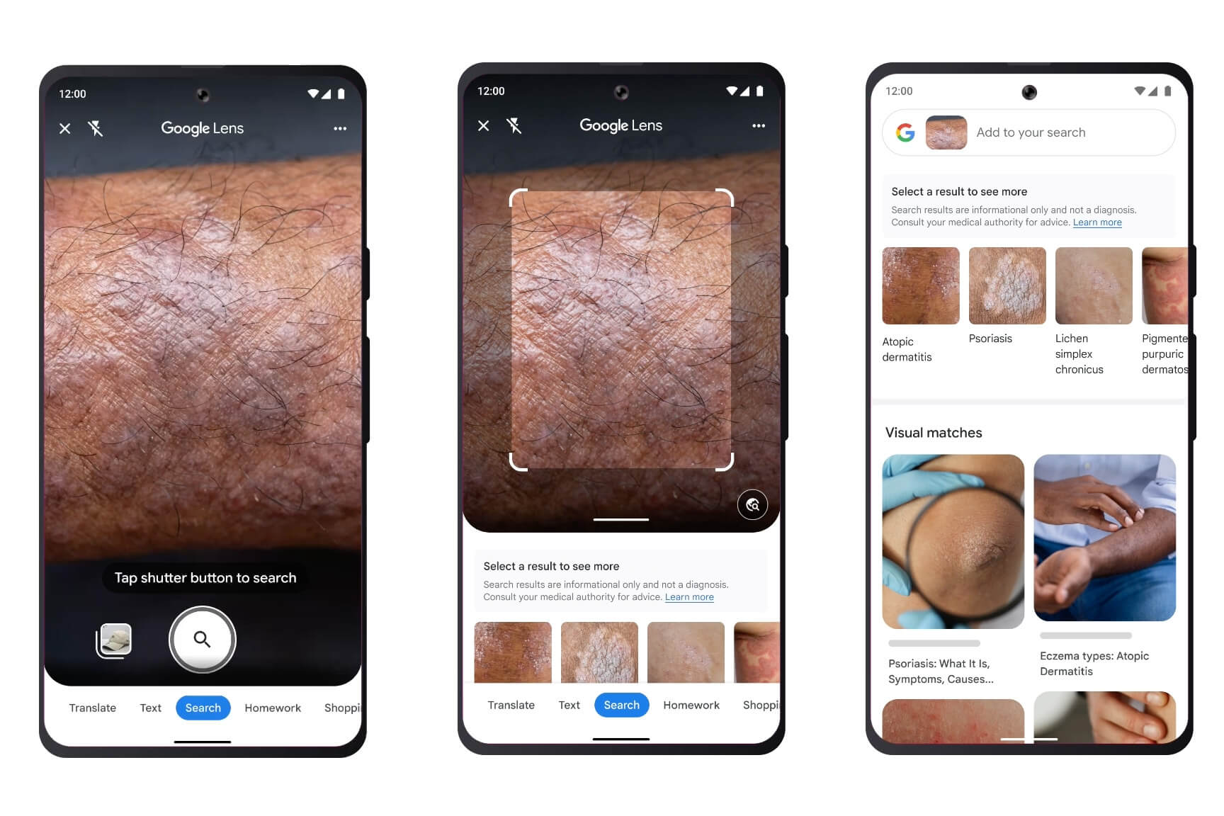 Google Lens научился распознавать заболевания кожи по фото